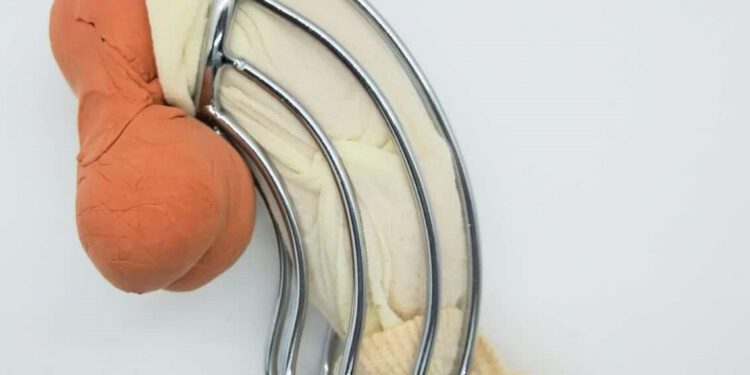 De aangepaste sokmethode om een kuisheidskooi aan te doen…