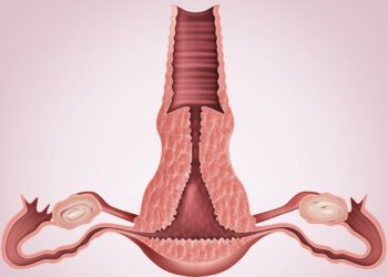 Ook mannelijke seksslaven: gebruik vaginaveilige zeep!