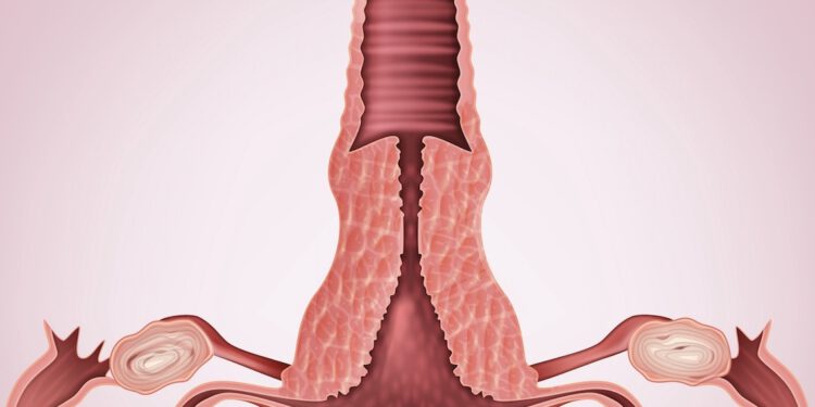 Ook mannelijke seksslaven: gebruik vaginaveilige zeep!